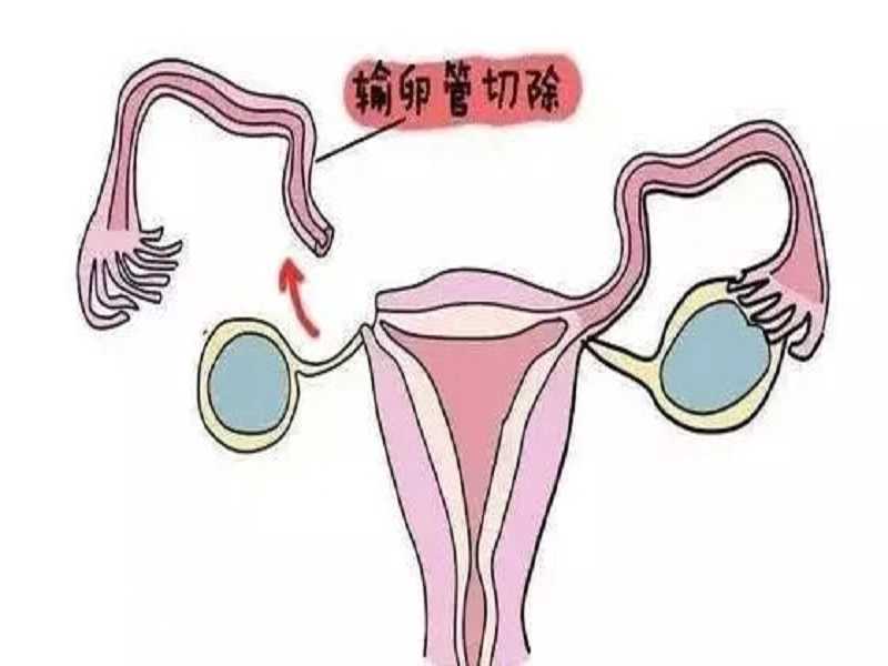 [婴儿健康]深圳试管供卵助孕医院排名