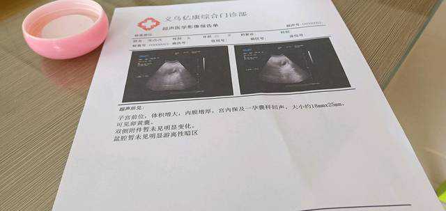 温州地下供卵医院，温州中山医院温州中山医院试管婴儿